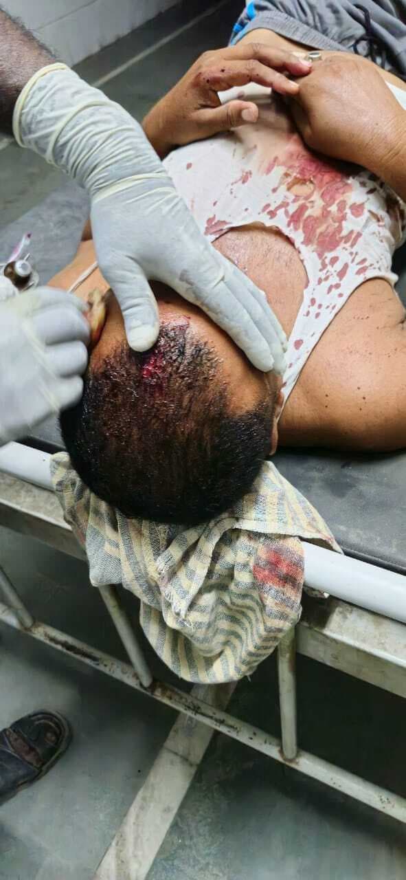 दो पक्षों के बीच हिंसक झड़प में तीन घायल, दो गिरफ्तार