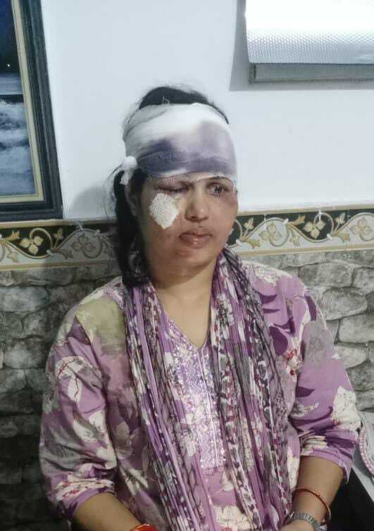 महिला मुखिया पर जानलेवा हमला, एक आरोपित गिरफ्तार