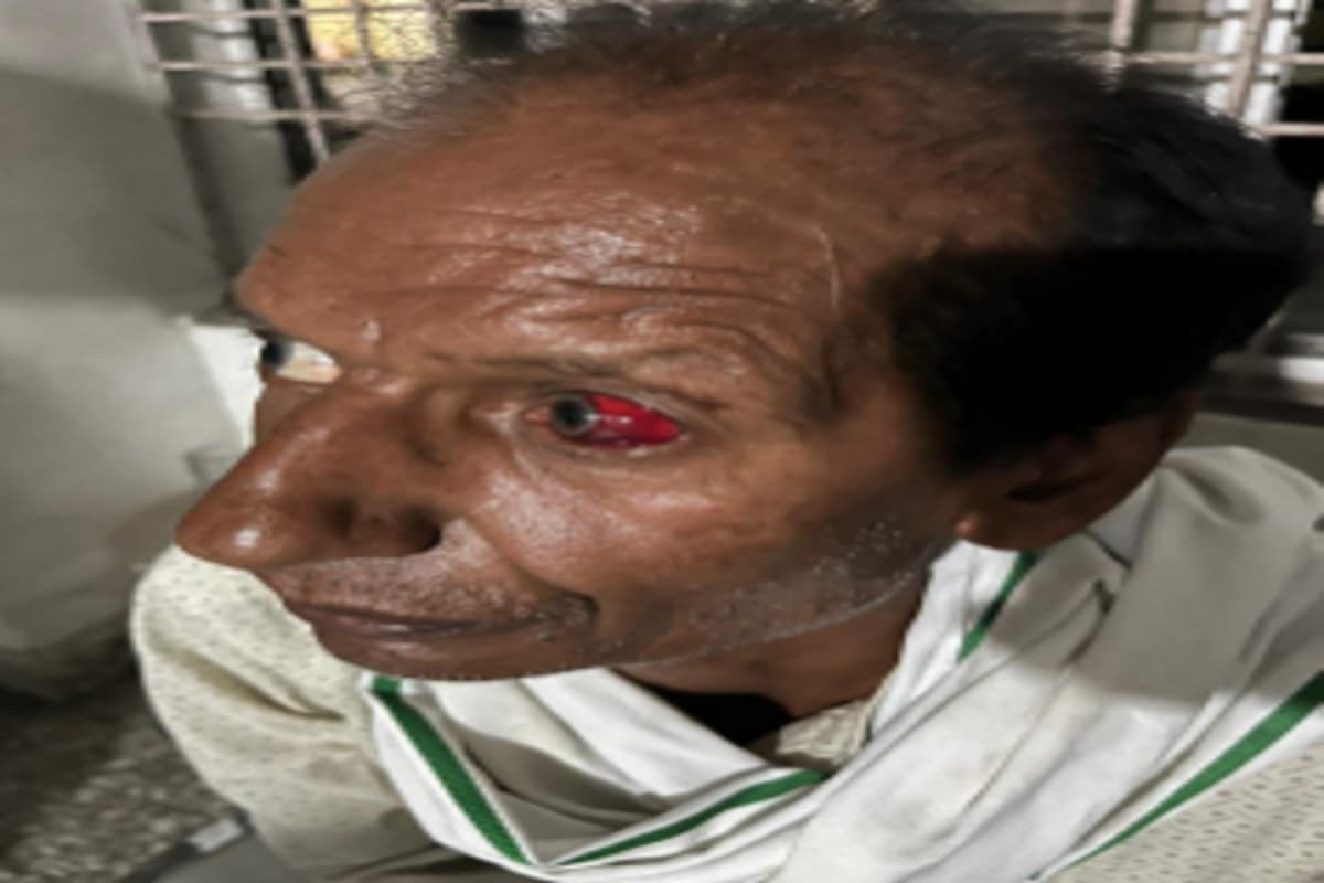 धनबाद के हर्ल परिसर में चोरों ने 2 कर्मियों को बंधक बनाकर की पिटाई, 5 लाख रुपये के कंट्रोल केबल की चोरी कर फरार