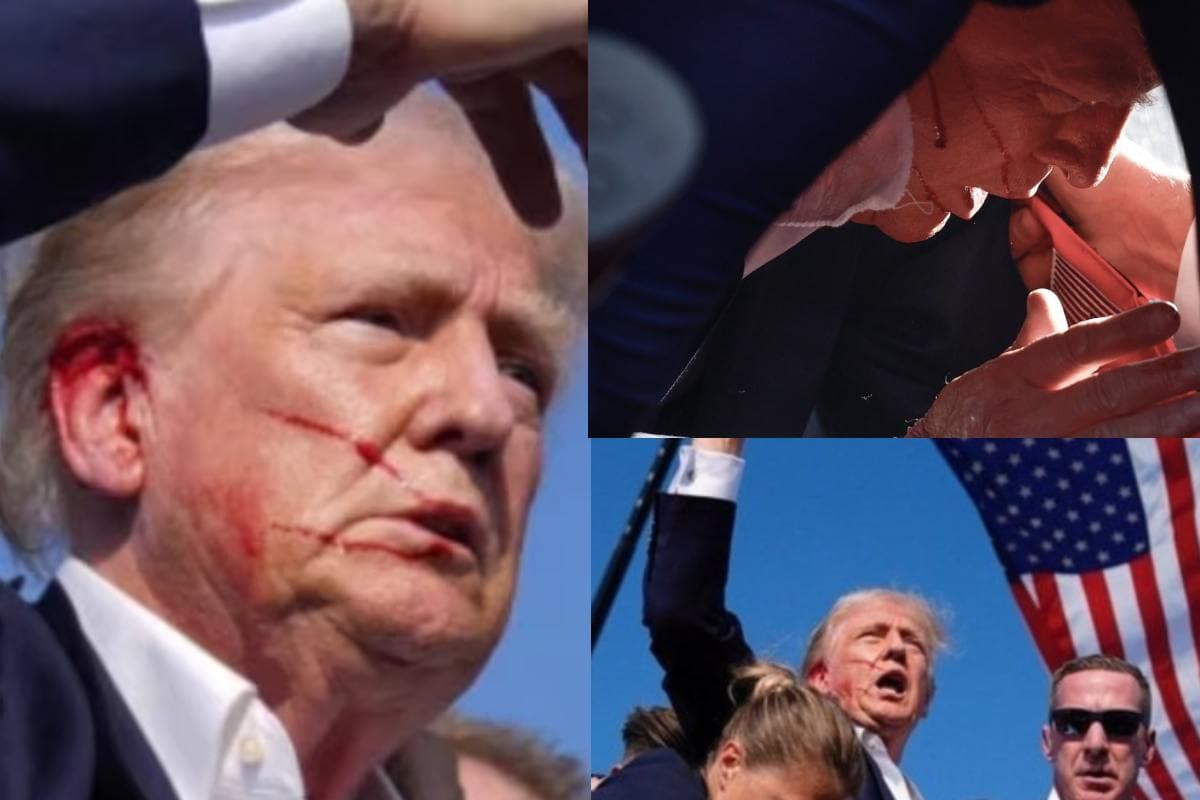 डोनाल्ड ट्रंप के कान में गोली नहीं लगी तो कैसे निकला खून? यह बड़ी बात आई सामने