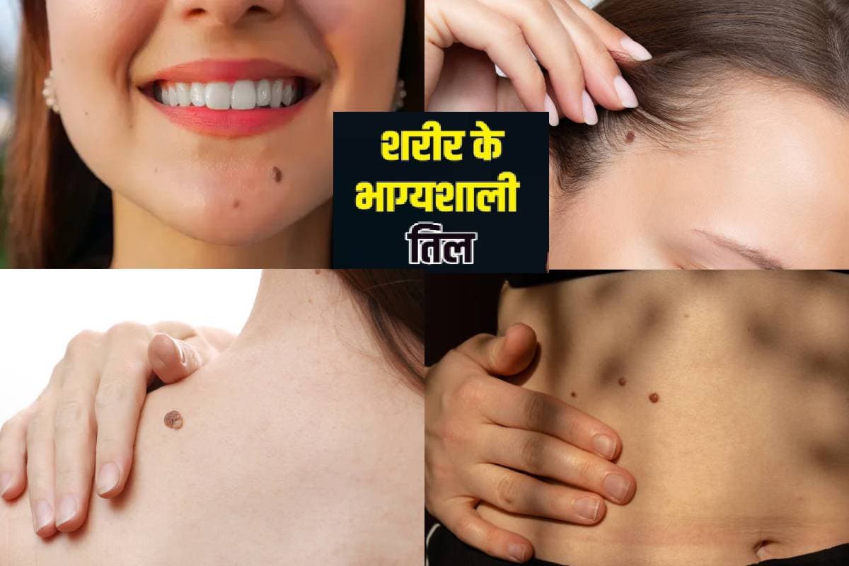 Meaning of Moles on Body: क्या आपके शरीर पर है भाग्यशाली तिल? जानें कितने LUCKY हैं आप