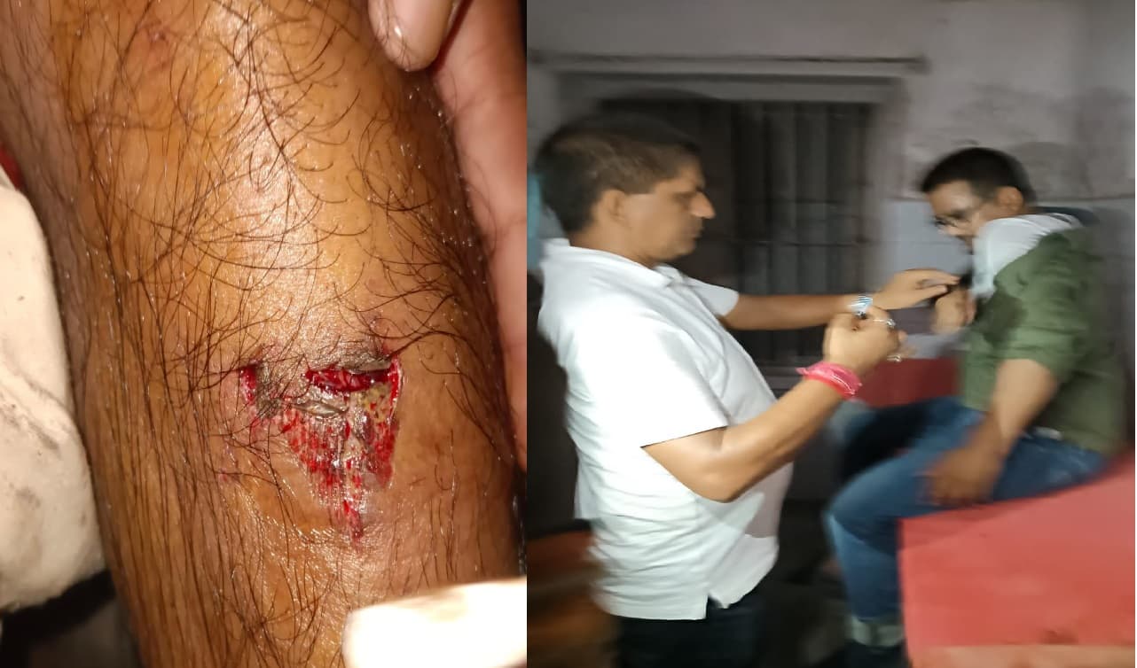 Patna News: पुलिस ने लैब टेक्नीशियनों को दौड़ा-दौड़ा कर पीटा, एक दर्जन से अधिक जख्मी