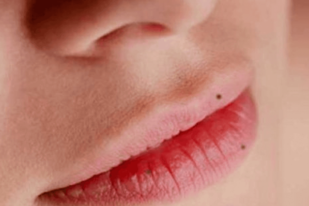 Mole On Lips: होठों पर तिल वाले लोगों का व्यक्तित्व कैसा होता है