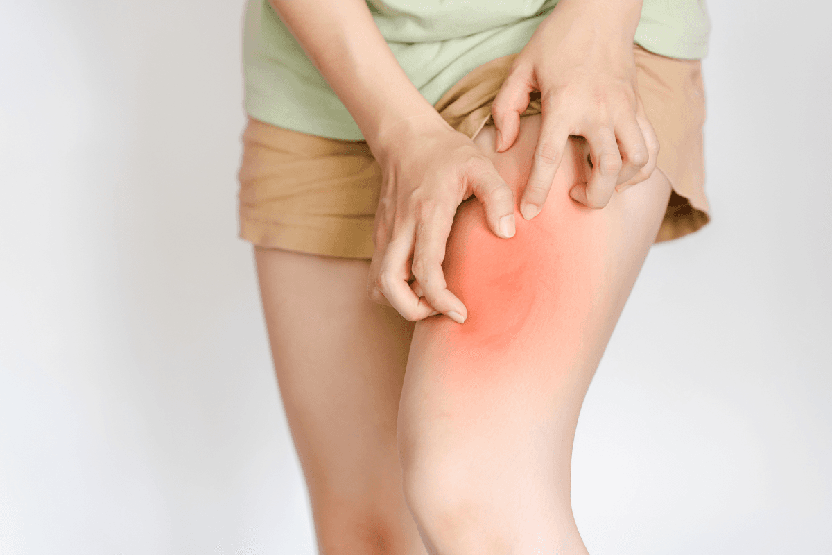 Home Remedies For Itching: बारिश के पानी से हो रही पैरों में खुजली और जलन? अपनाएं ये आसान
