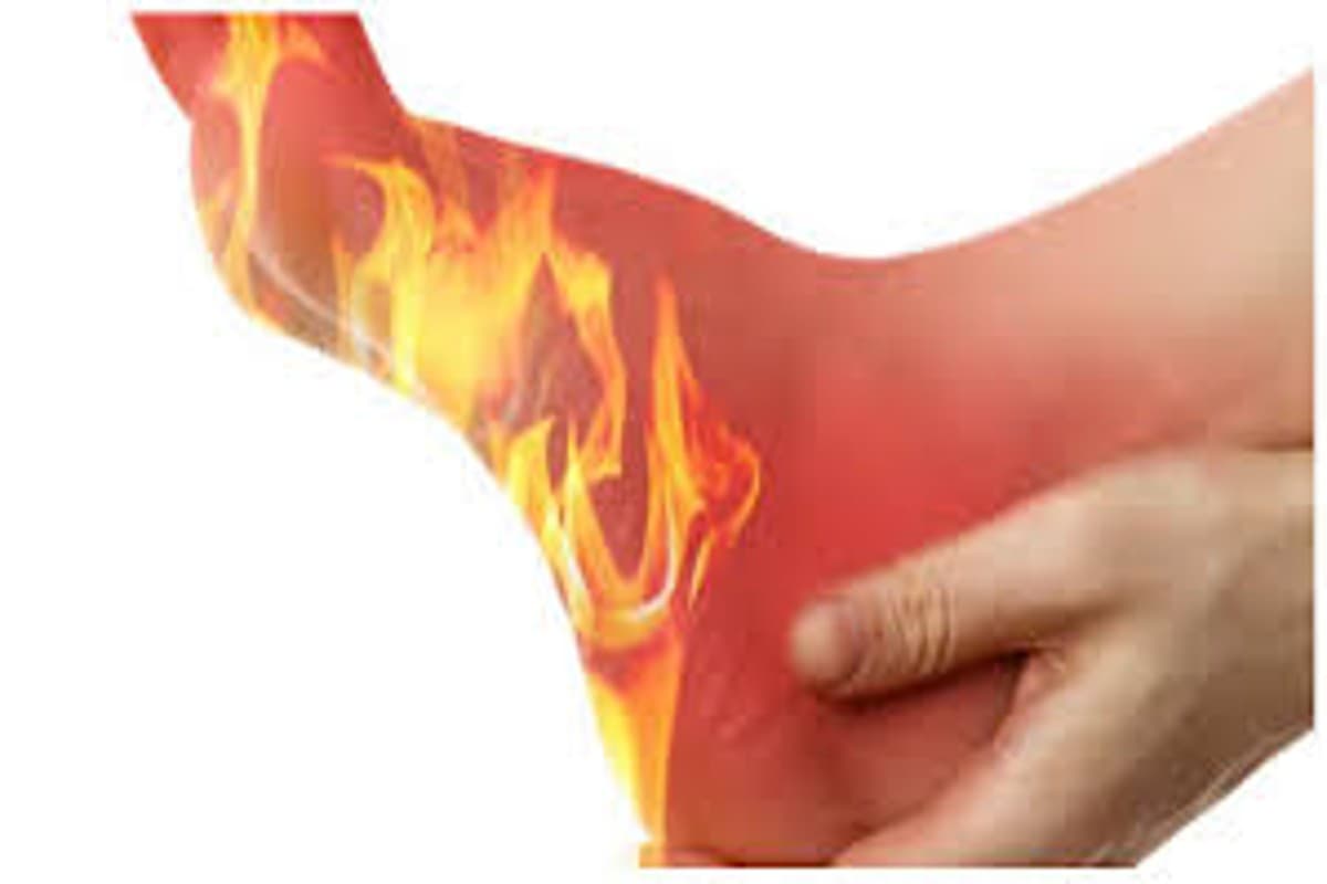 Vitamin Deficiency: किस विटामिन की कमी से होती है पैरों के तलवे में जलन?