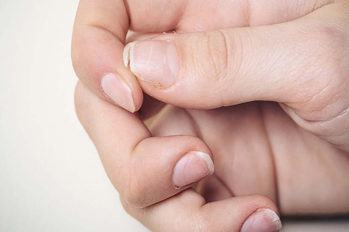 Calcium Deficiency in Men : क्या है पुरुषों में कैल्शियम की कमी का कारण?