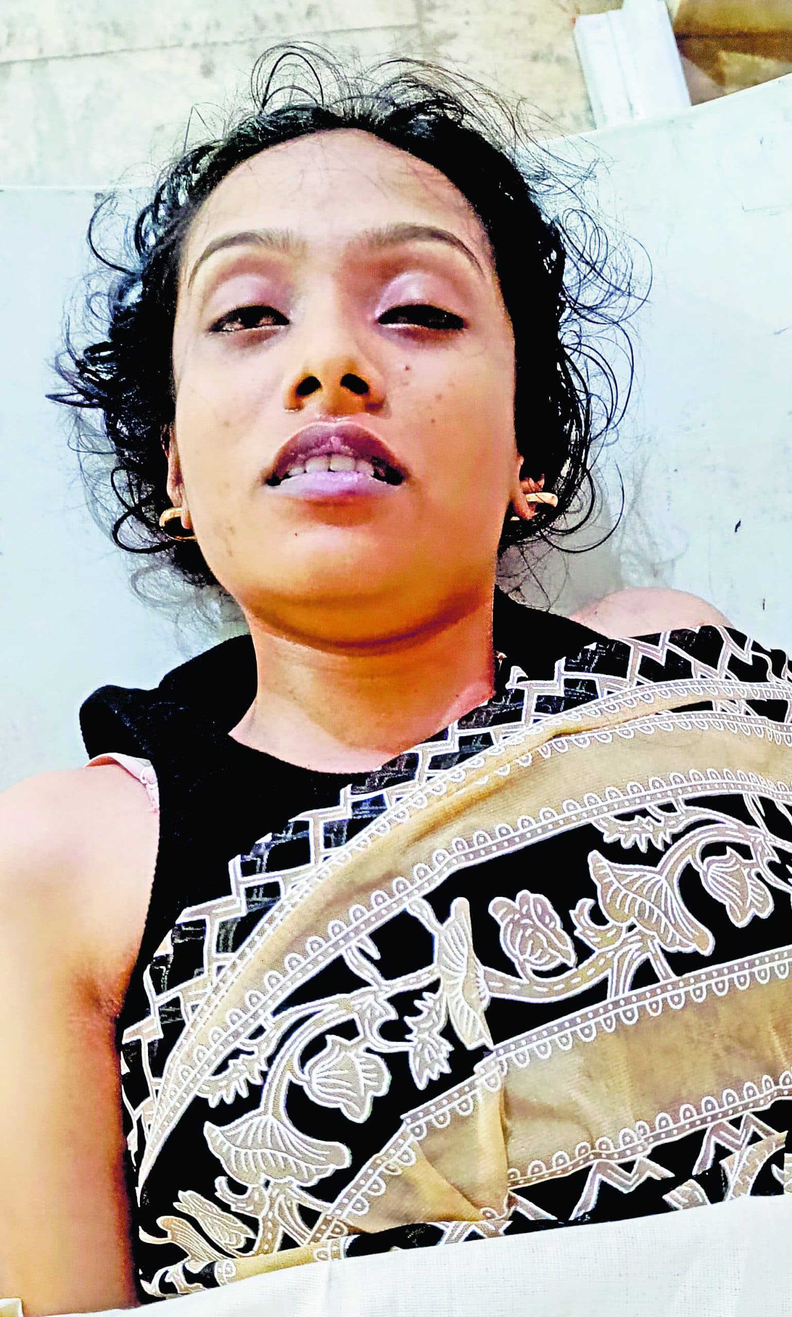 घाटशिला घूमने पहुंची छात्रा की पहाड़ पर चढ़ते समय दम फुलने से हुई मौत