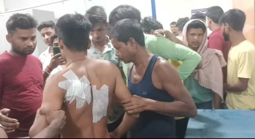 आपसी रंजिश में एक युवक ने दूसरे युवक को चाकू मारकर किया जख्मी, रेफर