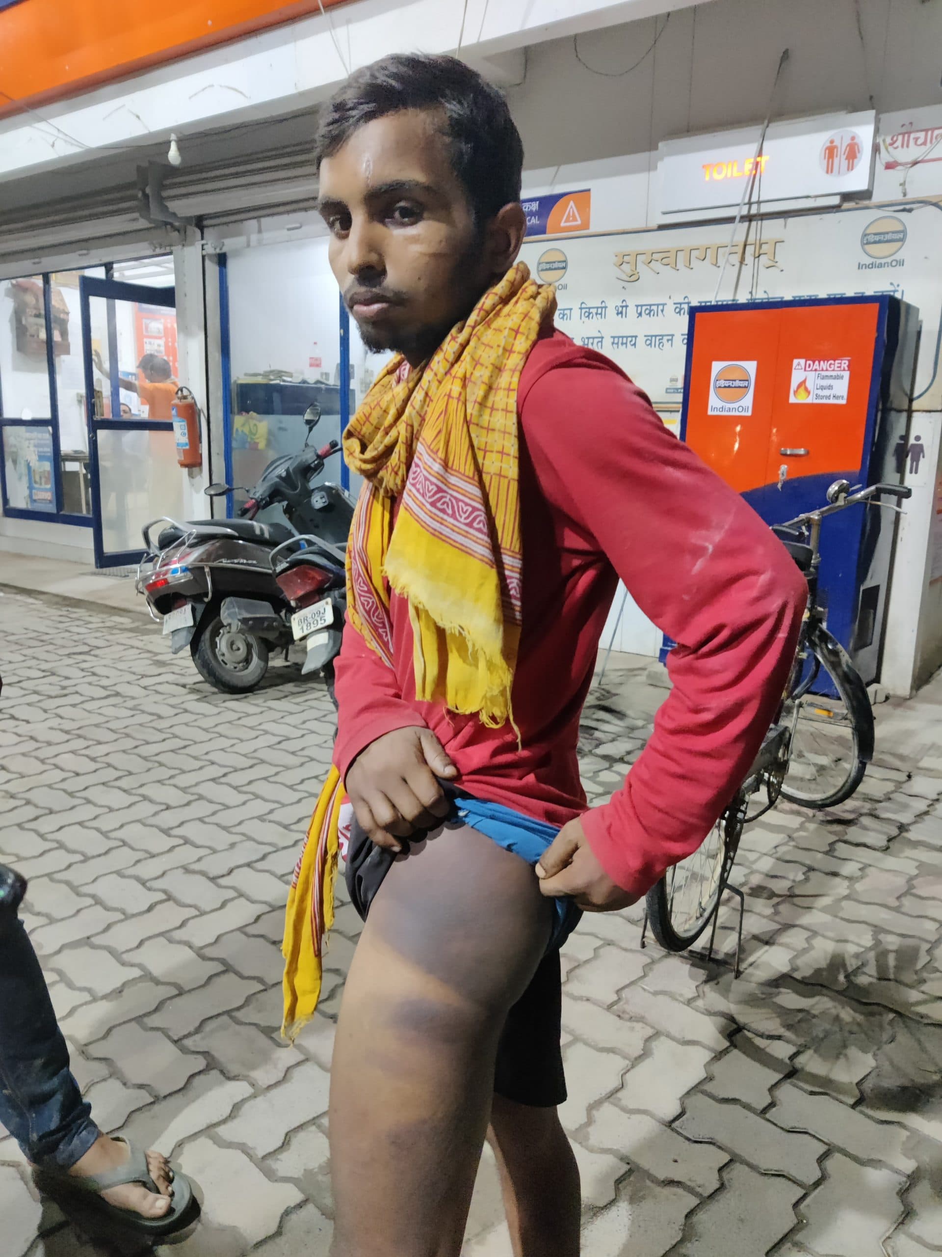 हथिदह थानाध्यक्ष पर नौकर को बंधक बना पिटाई का आरोप, निलंबित