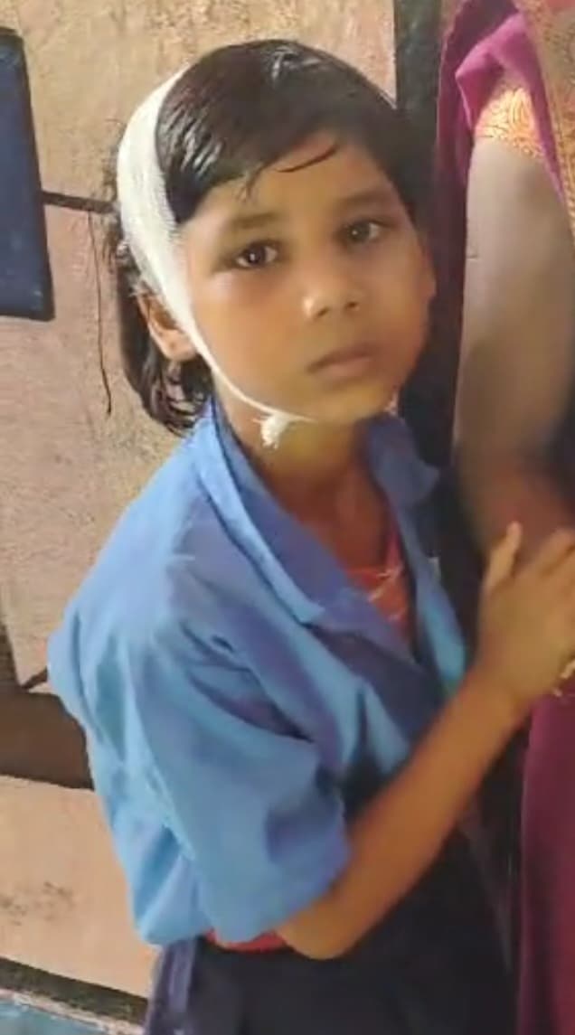 स्कूल में गिरा छत का प्लास्टर, चार बच्चे जख्मी