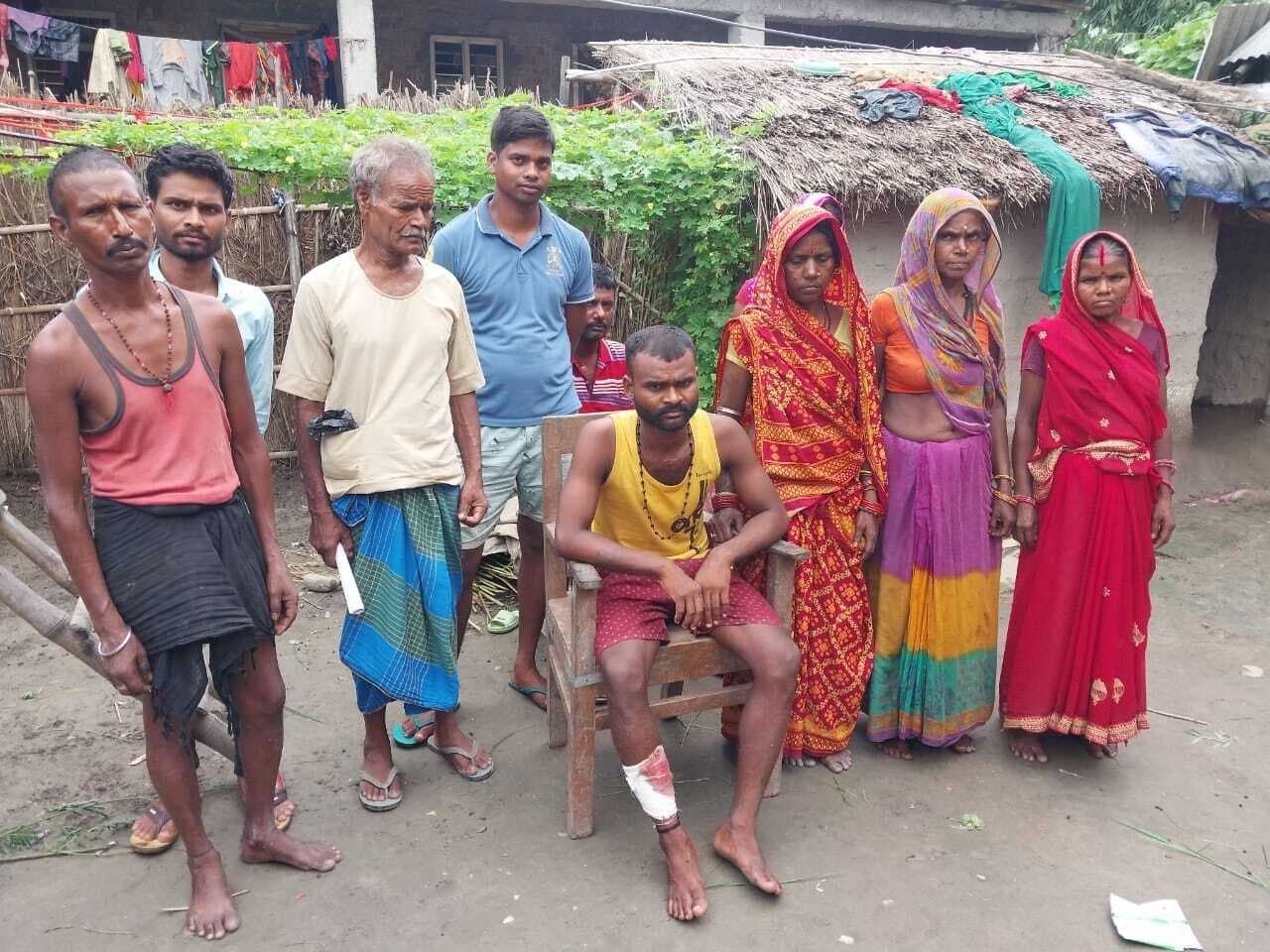 अपराधियों ने बाइक सवार युवक को मारी गोली, जख्मी