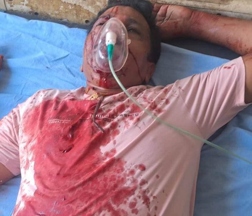 खड़े ट्रक में बोलेरो ने मारी टक्कर, पिता, पुत्र और चालक जख्मी, हायर सेंटर रेफर