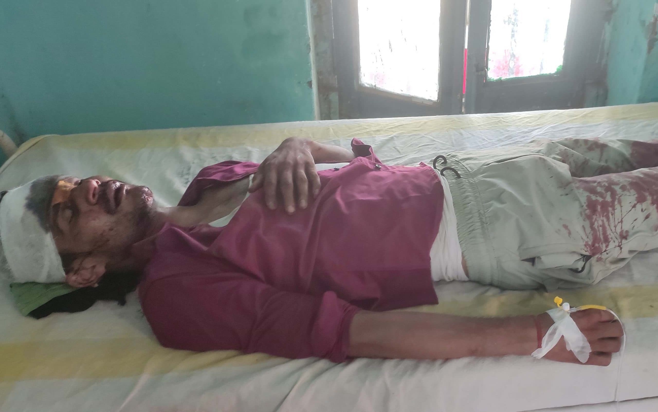 बाइक की ठोकर से युवक गंभीर रूप से घायल,  रेफर