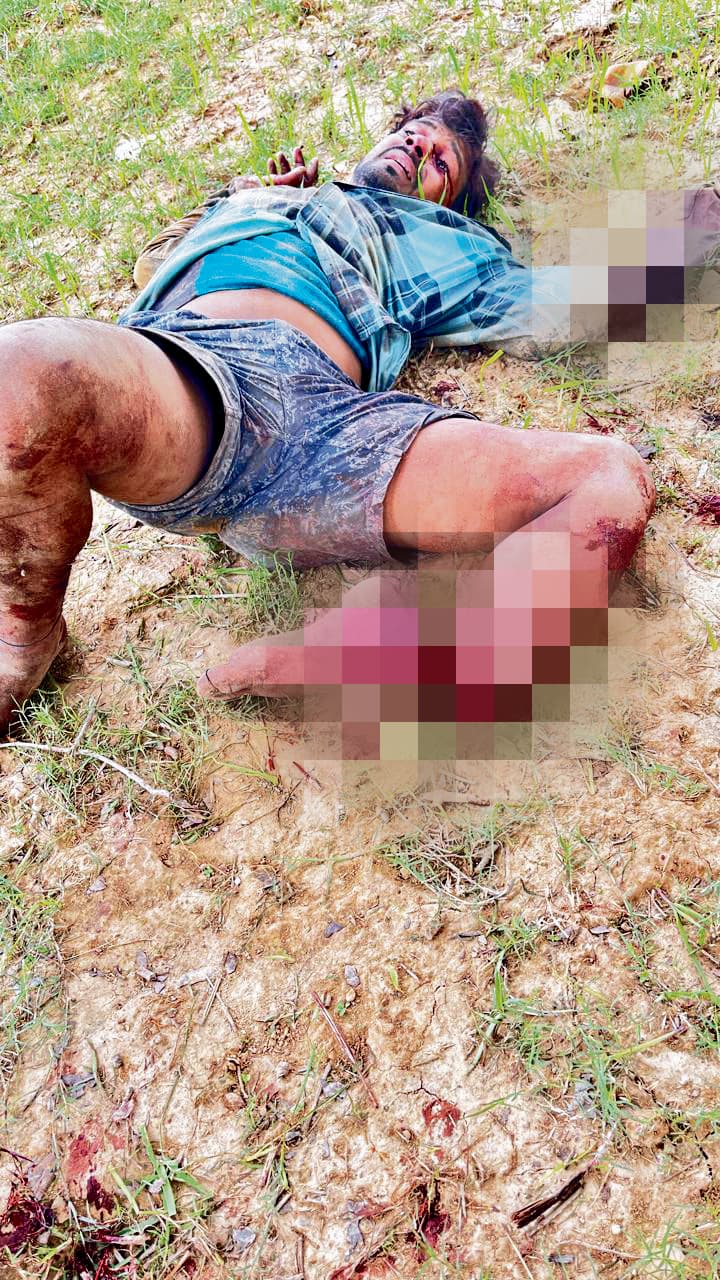 आपसी झगड़े में अपराधियों ने युवक के हाथ और पैर काटे