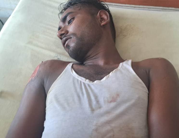 सड़क दुर्घटनाओं में मोटरसाइकिल सवार सात लोग घायल