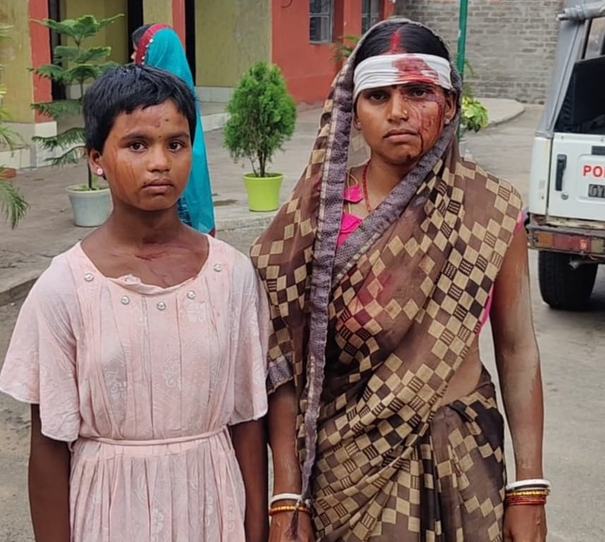 जमीन विवाद में दो पक्षों में मारपीट, तीन महिला समेत पांच घायल