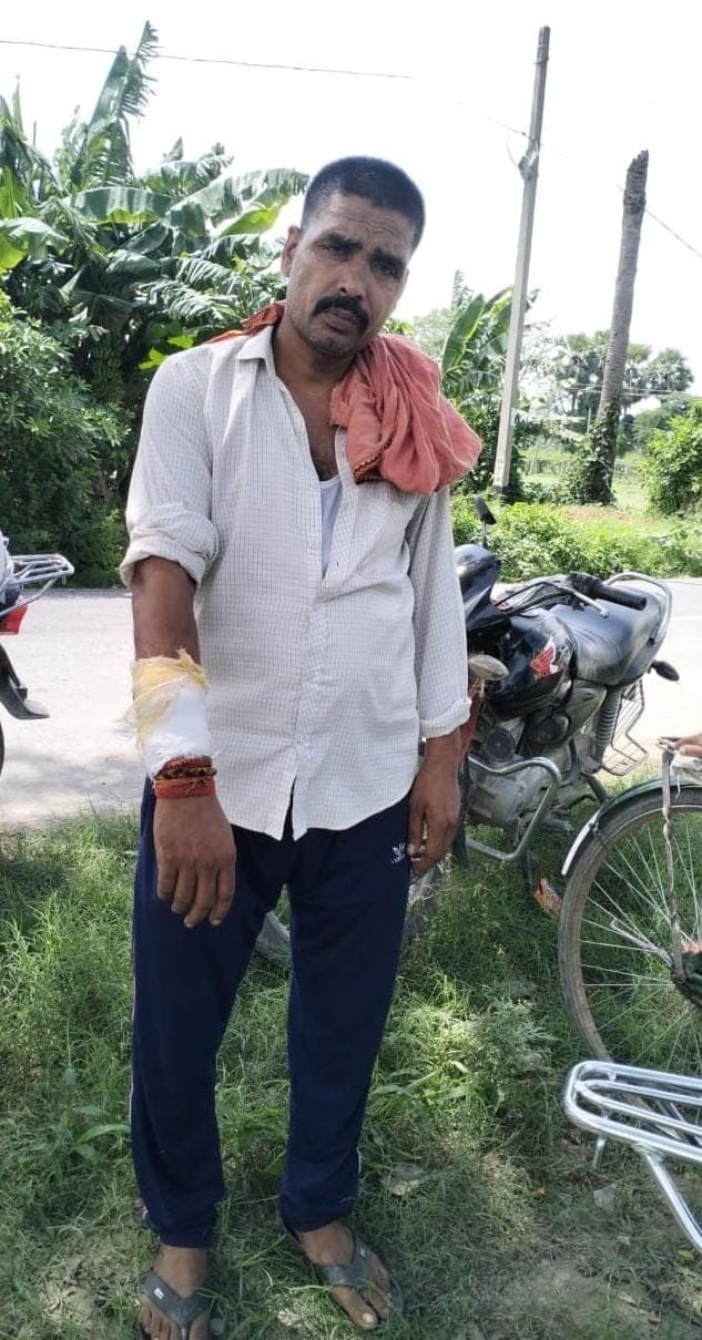 स्कूटी सवार बदमाशों ने होमगार्ड जवान को जख्मी कर लूटी बाइक