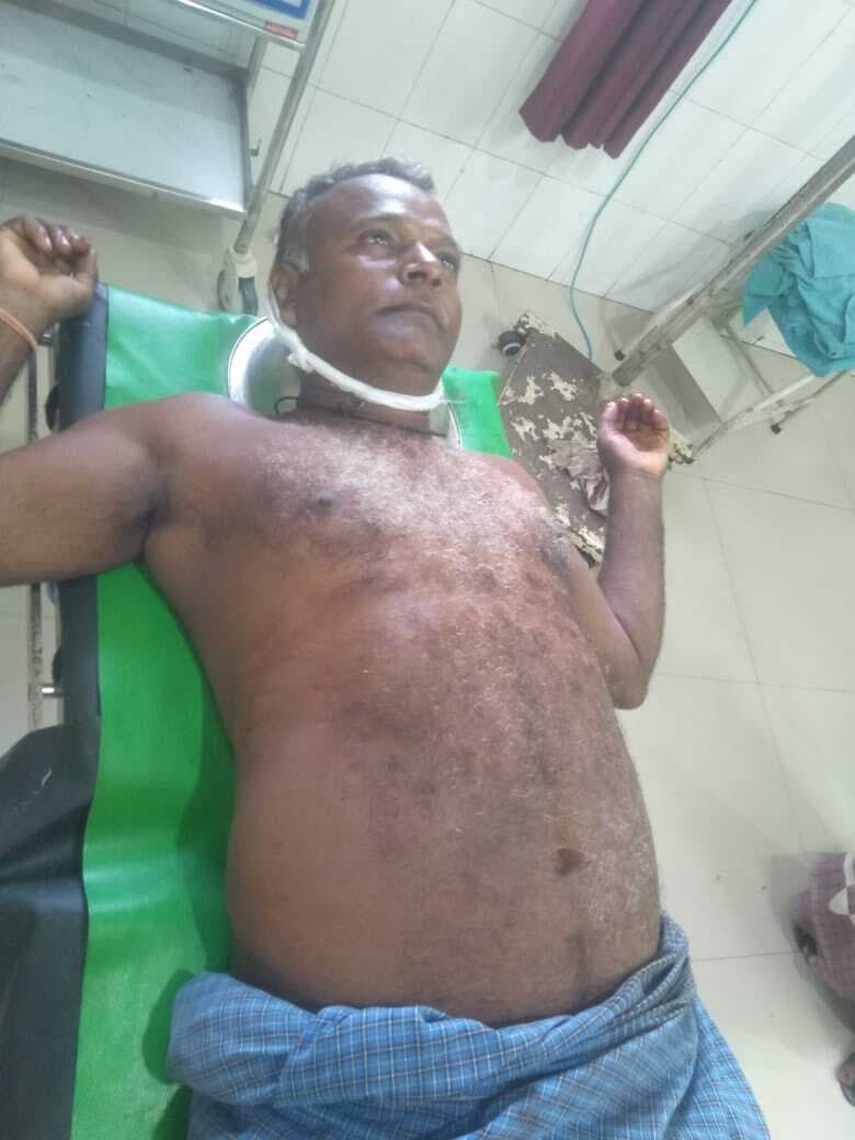 रड से जानलेवा हमला कर युवक का सिर फोड़ा