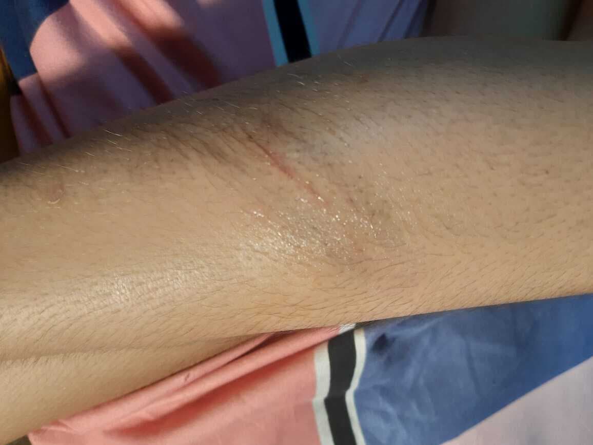 Ranchi news : डीएवी गांधीनगर के शिक्षक पर बच्चों को पीटने का आरोप, स्कूल ने किया सस्पेंड