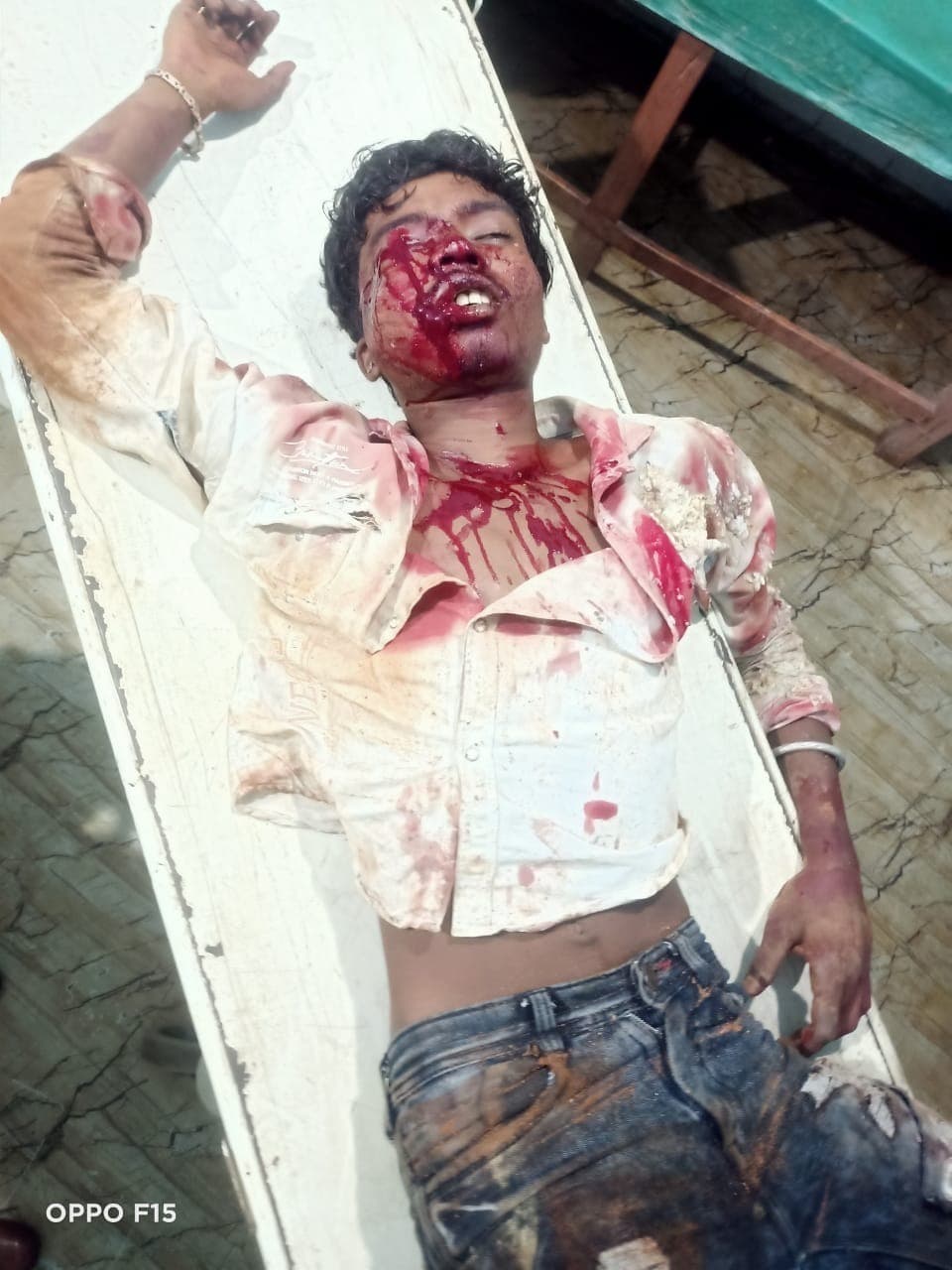 पेड़ से टकरायी बाइक, चालक घायल, रेफर