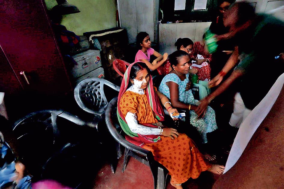 गिरीश पार्क : कमरे में लगी आग, महिला का जला हाथ