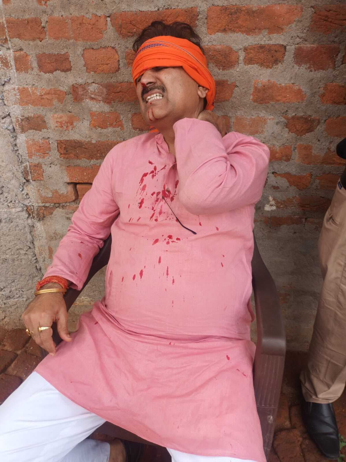 हादसे में भाजपा जिलाध्यक्ष समेत चार घायल