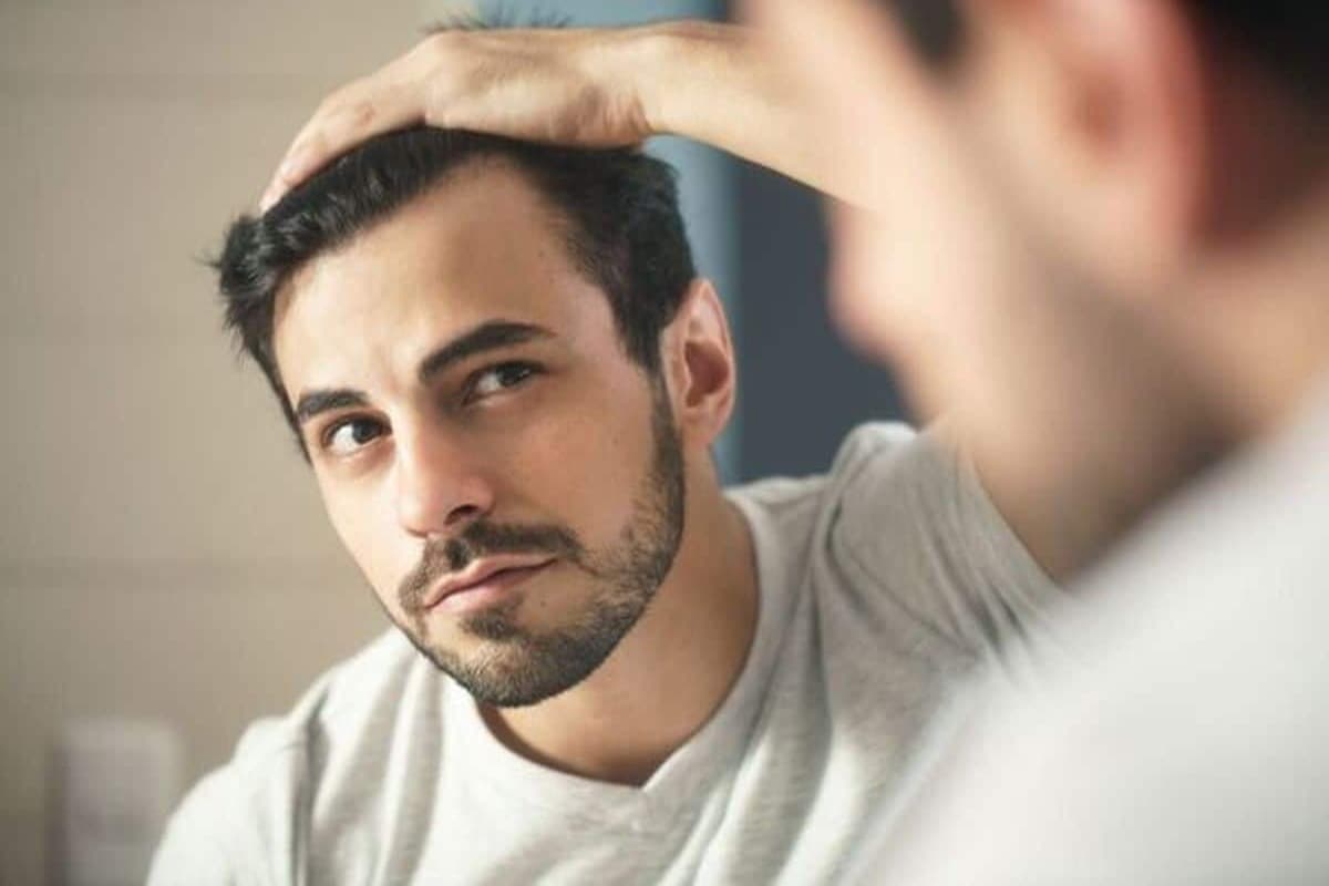 Hair loss Problem in Men: क्यों होती है पुरुषों में बाल झड़ने की समस्या, जानिए कारण एवं इलाज.