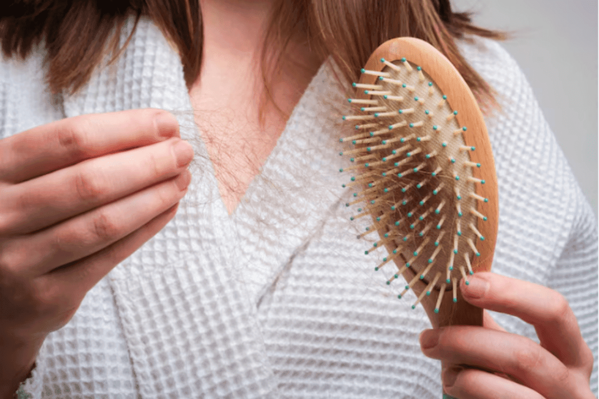 Hair Loss : क्या विटामिन की कमी से हो सकती है बाल झड़ने की समस्या?