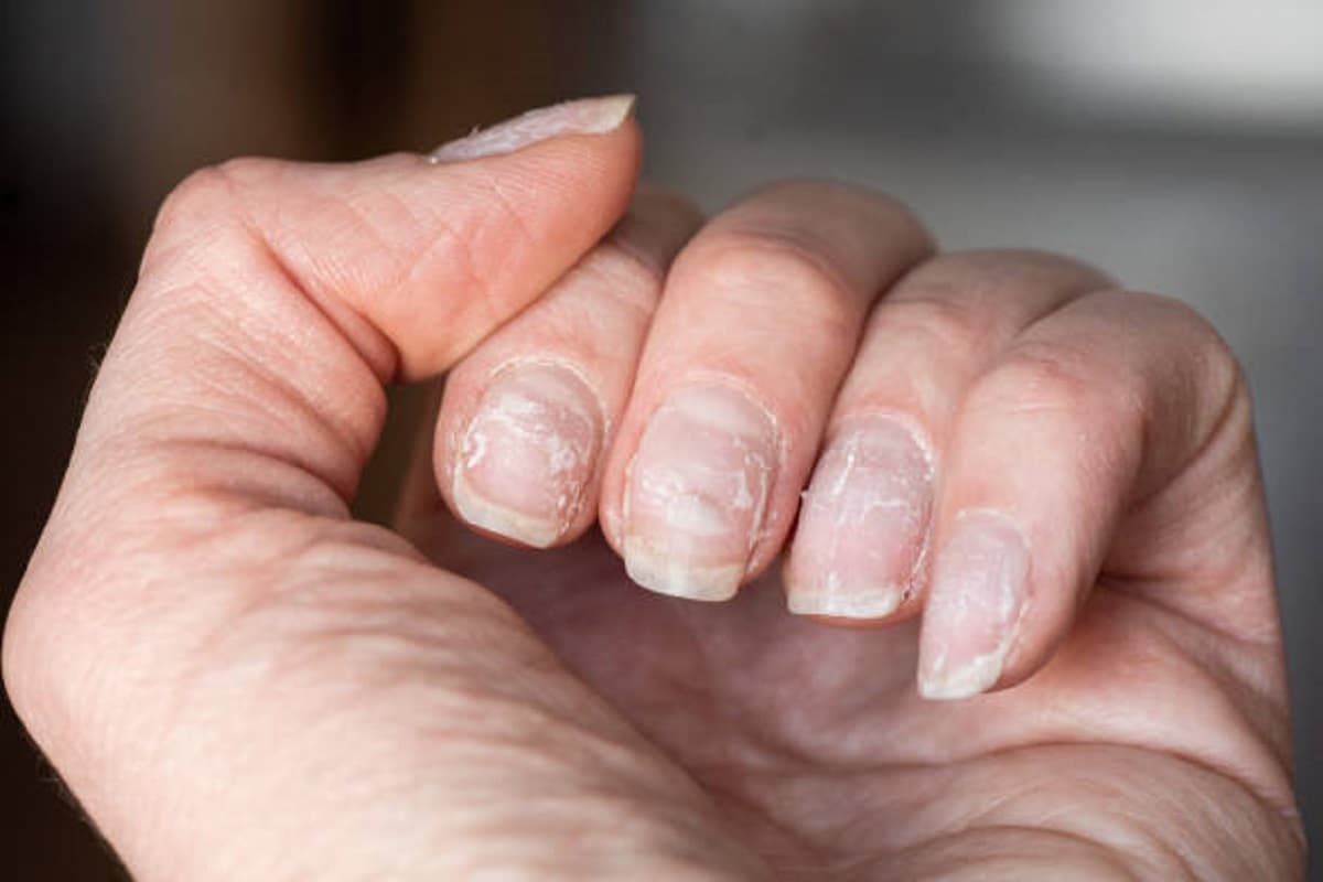 Nail Care: ये संकेत बताते हैं कि आपके नाखूनों को देखभाल की जरूरत है