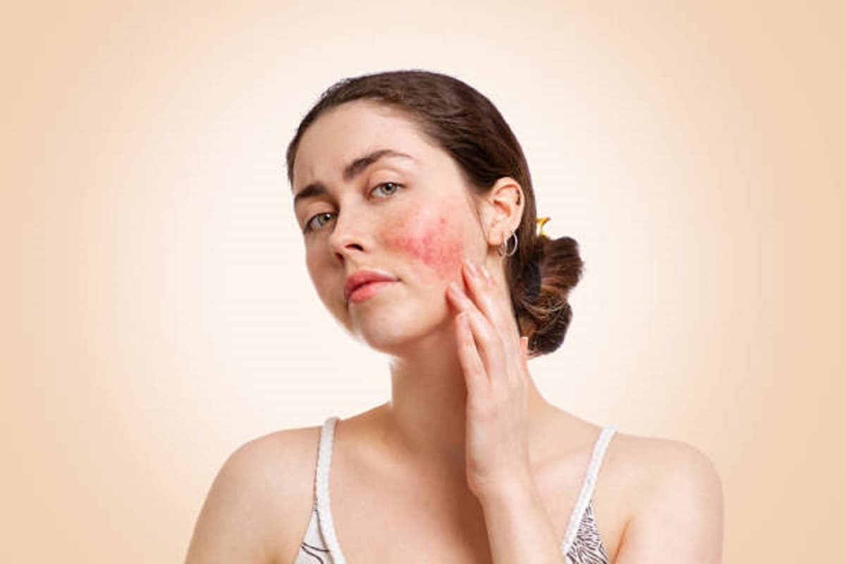 Skin Care Tips: इन लक्षणों से पता कीजिए, आपको कोई स्किन प्रॉब्लेम तो नहीं