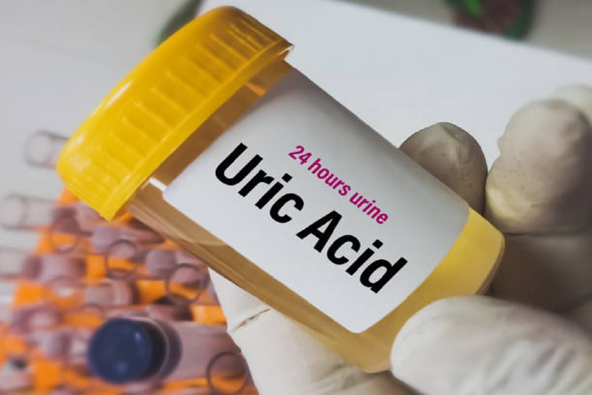 Health Tips: इन चीजों को खाने से कम होगा बढ़ा हुआ यूरिक एसिड