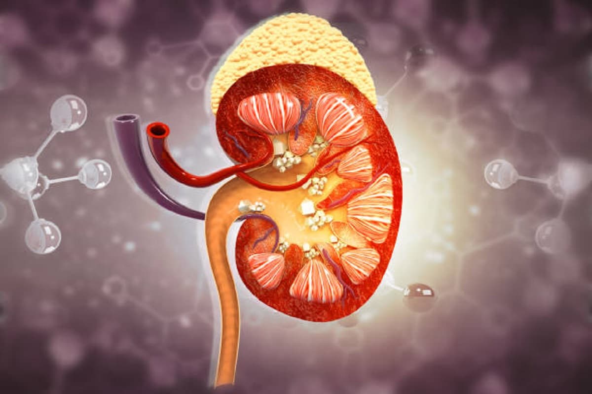 Health Tips: जानिए युवाओं में क्यों बढ़ रही है  पथरी की समस्या