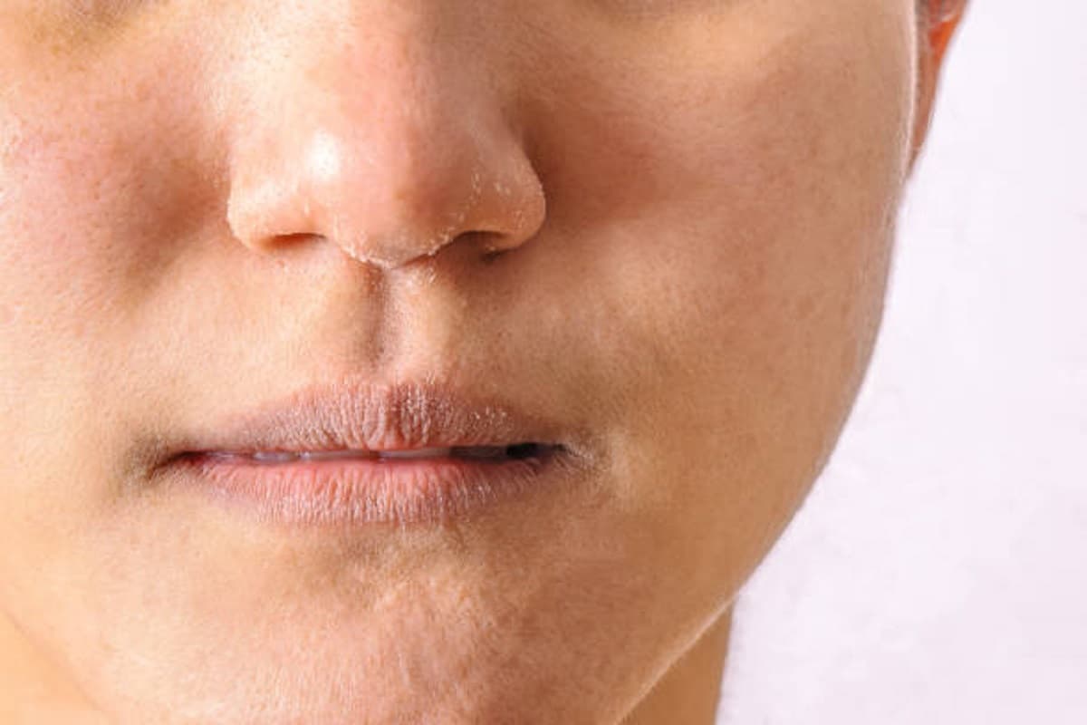 Lip Care: मानसून में होंठ दिखतें हैं खुरदरे और पीले, इन तरीकों से होगा फायदा
