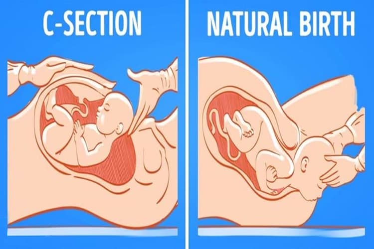 Pregnancy Tips : अगर आप भी चाहती हैं नॉर्मल डिलीवरी, तो फॉलो करें इन 10 टिप्स को..