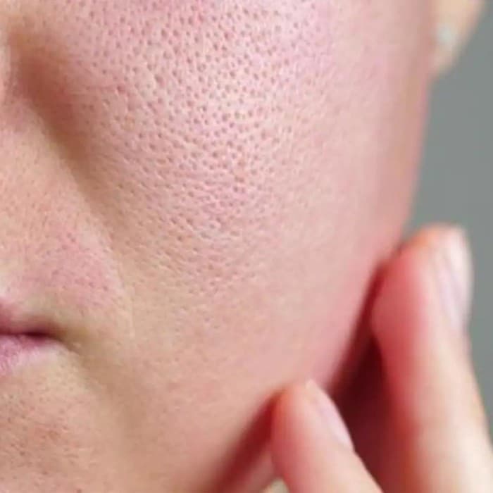 Beauty Tips : ओपन पोर्स के कारण कम हो गई है खूबसूरती, नेचुरल मास्क देगा निखार