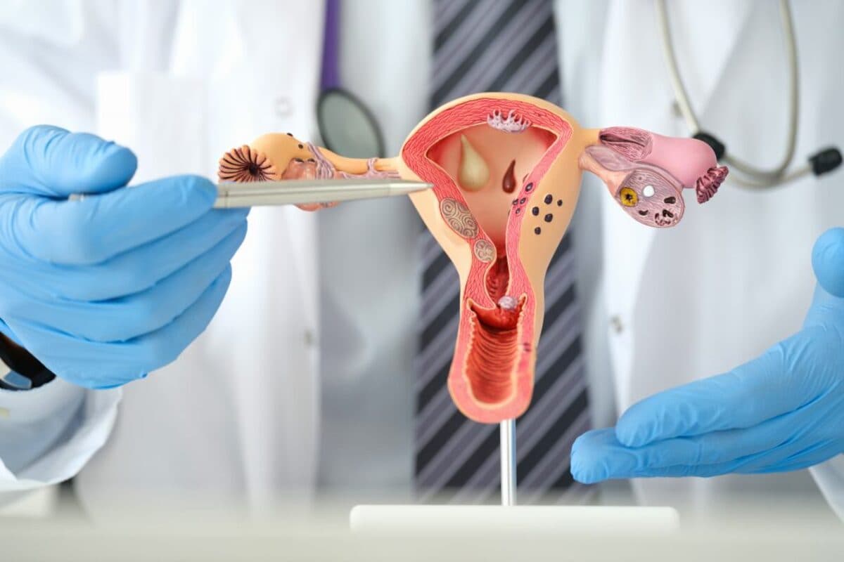 Uterus Cancer : महिलाओं में बढ़ रहा है गर्भाशय के कैंसर का खतरा? क्या हैं इसके प्रकार और लक्षण ?