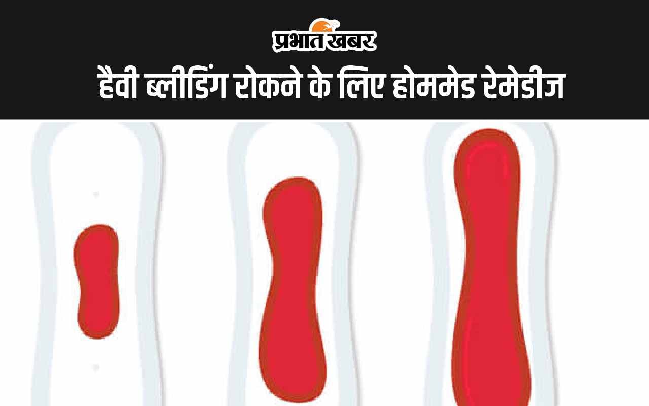 Heavy Bleeding In Menstruation: हैवी ब्लीडिंग रोकने के लिए होममेड रेमेडीज