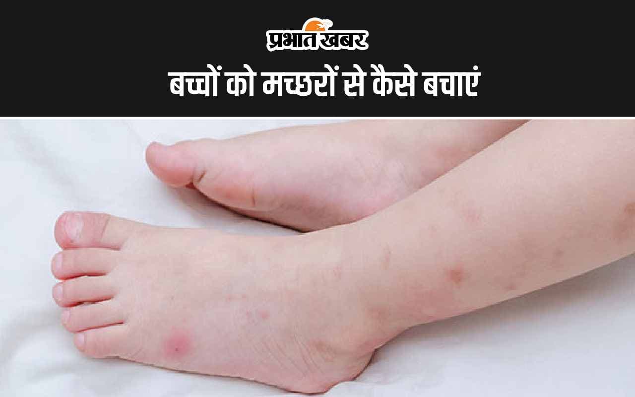 Mosquito Bites: बच्चों को मच्छरों से कैसे बचाएं जानिए आसान टिप्स