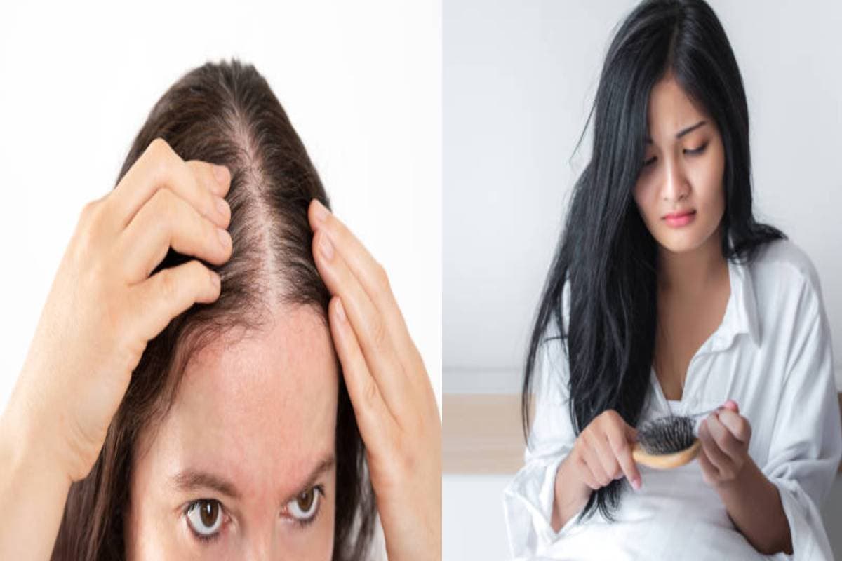 Monsoon Hair Care Tips: 3 दिन में बालों का झड़ना होगा कम, डॉक्टर ने बताए अचूक उपाय, देखें VIDEO