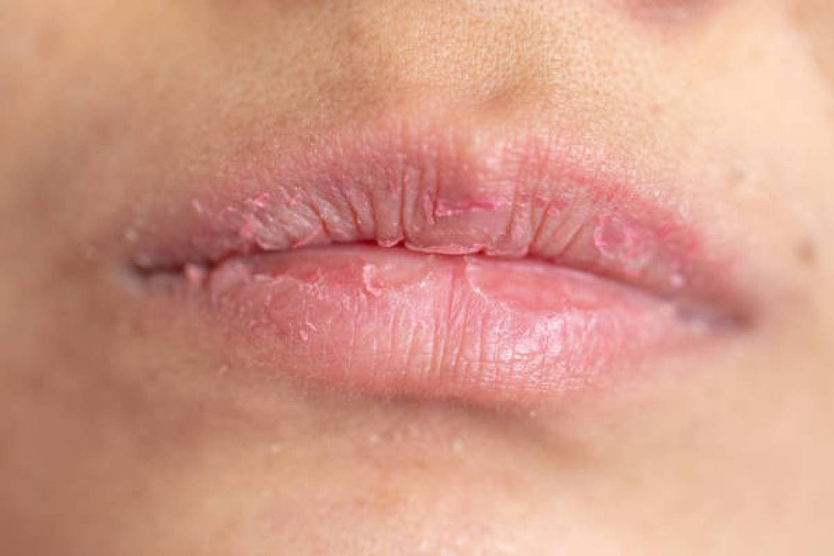 Homemade Lip Scrub: ड्राई होंठ के लिए फायदेमंद है होममेड स्क्रब, जानें बनाने और लगाने का तरीका