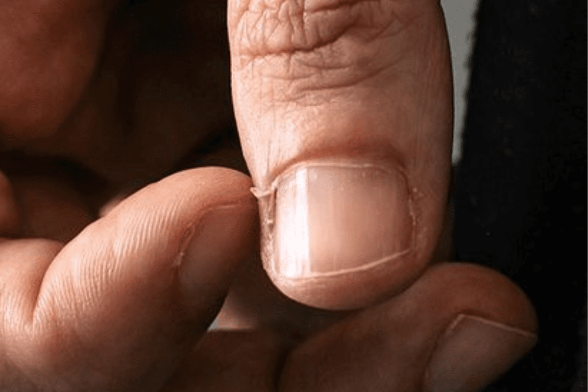 Nail Care Tips: नाखून के बगल की स्किन निकलने से अगर आप भी है परेशान तो अपनायें ये टिप्स