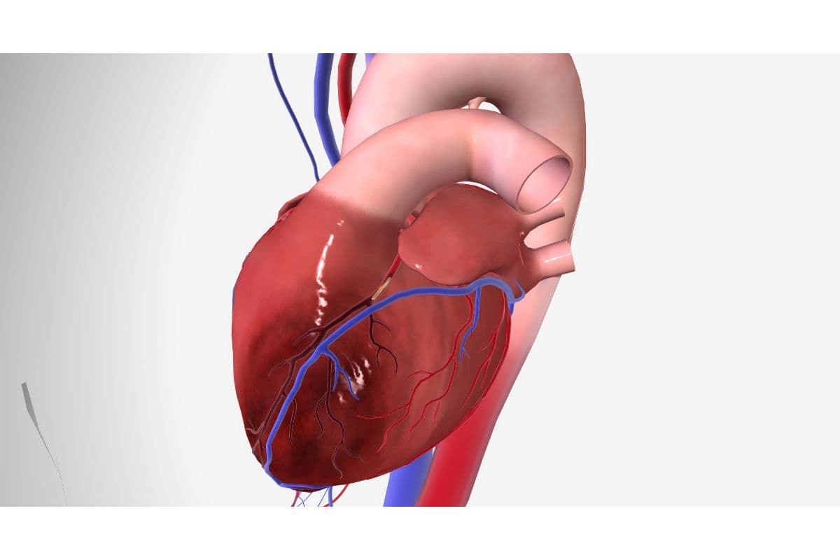 Myocarditis remedies: मायोकार्डिटिस के लिए घरेलू उपचार और देखभाल के उपाय