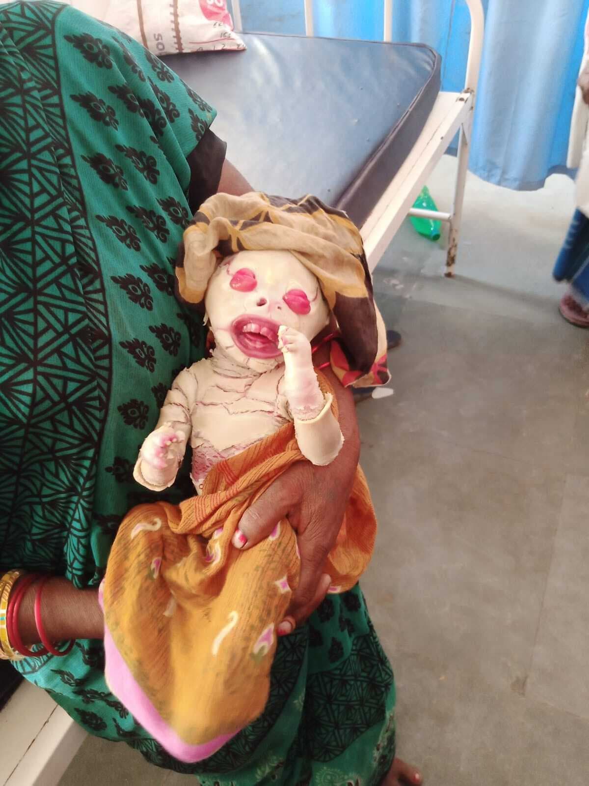 रामनगर पीएचसी में एक महिला ने विचित्र बच्चे को दिया जन्म