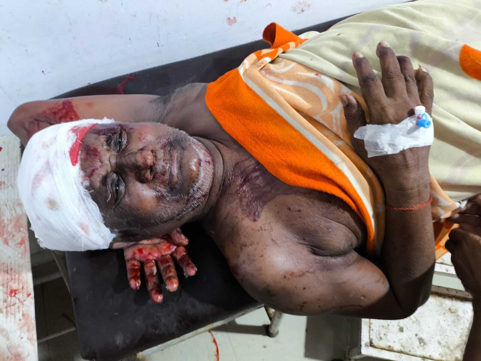 आपसी विवाद में मारपीट, दो लोग घायल