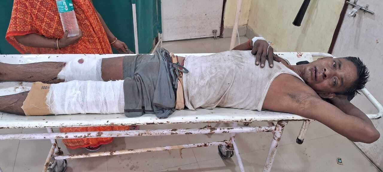 वाहनों की टक्कर में टैंकर चालक घायल, सदर अस्पताल ने किया रेफर