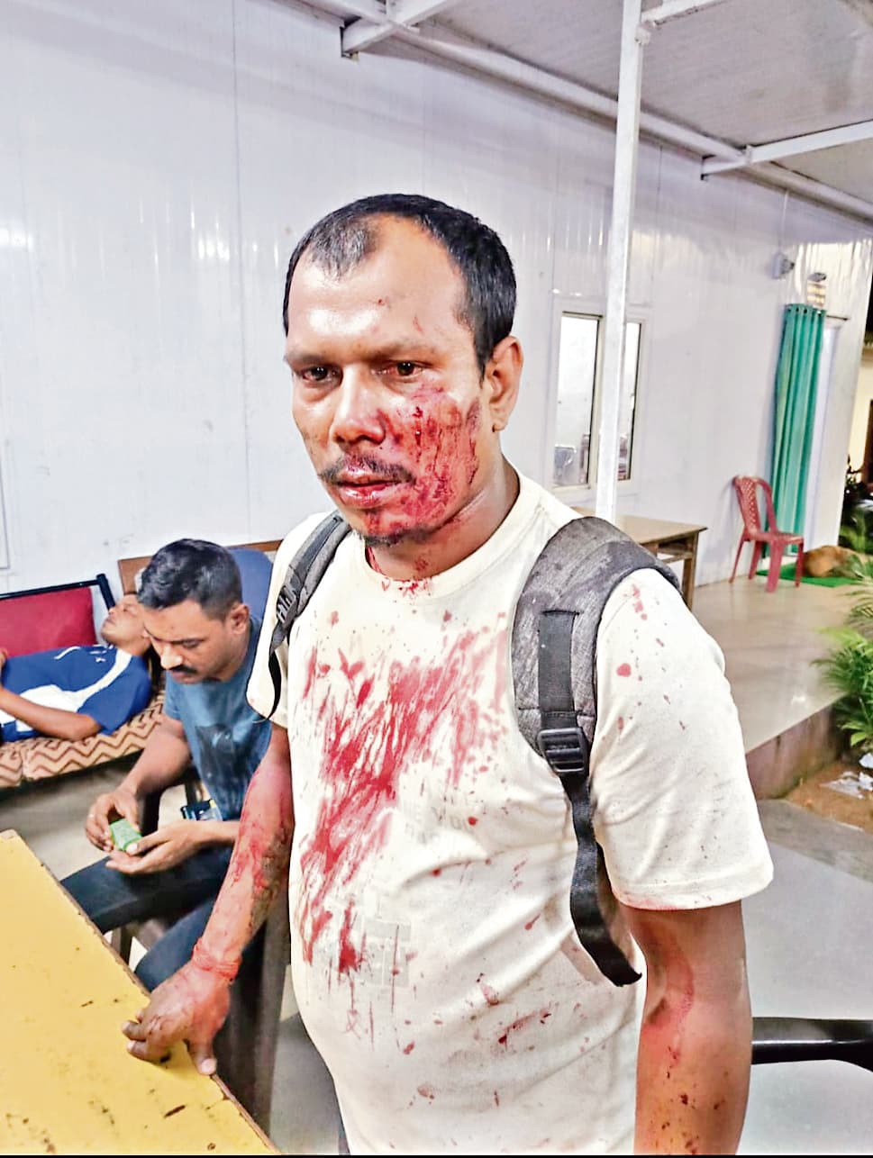 स्विगी डिलीवरी ब्वॉय से मारपीट, तीन दिन बाद दर्ज हुआ केस