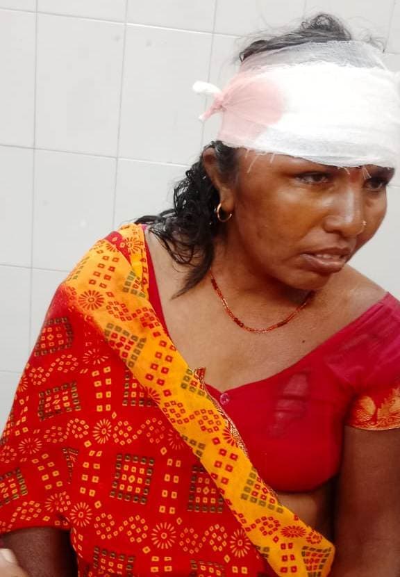 देवघर जा रहे जमुई के दंपती ट्रक के धक्के से घायल, भागलपुर रेफर