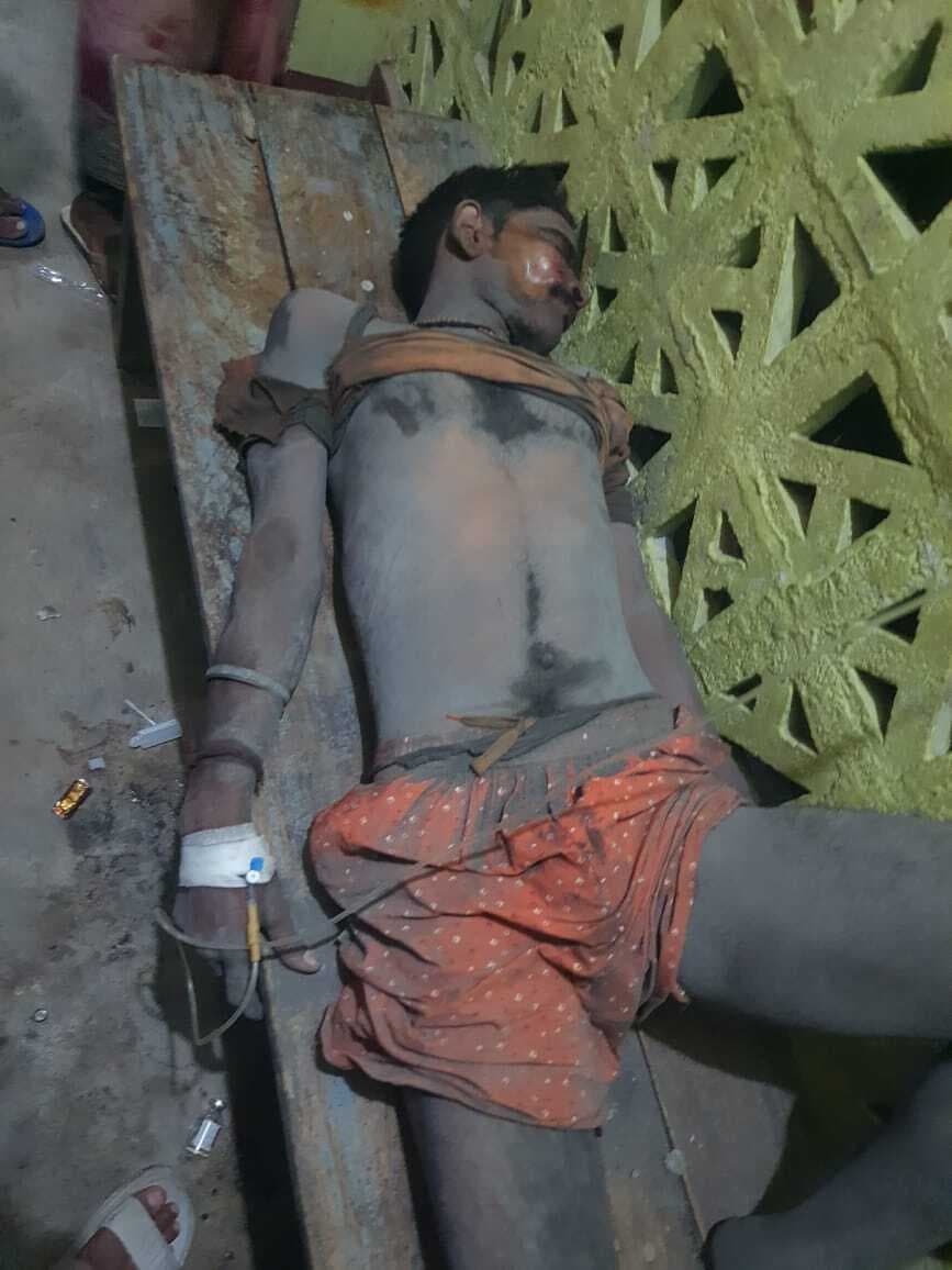 कनौसी गांव में करेंट की चपेट में आने से बिजली मिस्त्री घायल