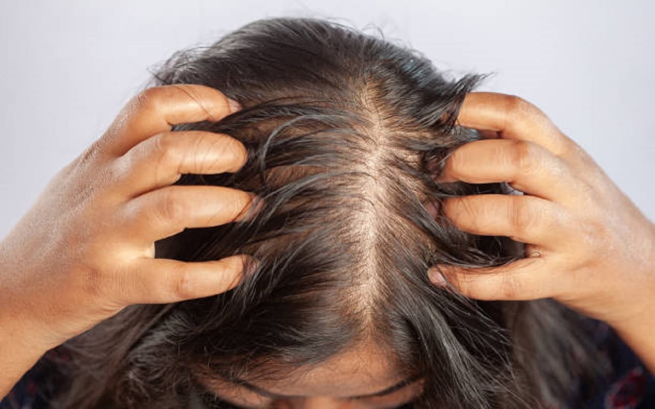 Hair Care Tips: ऑइली स्कैल्प से छुटकारा पाने के लिए अपनाएं ये घरेलू उपाय
