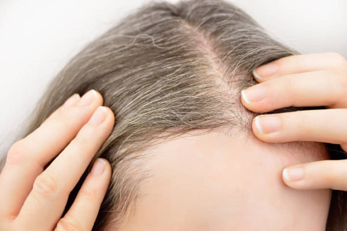 Hair Care Tips: बालों को काला करने के लिए अपनाएं ये प्राकृतिक उपाय